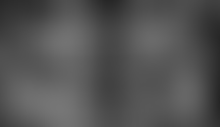 Panoramic radiograph