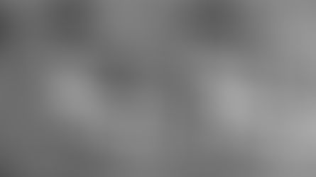 A 9-Year Longitudinal Follow-up of IS-III Implants: Clinical Outcomes from 2017 to 2025