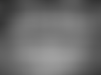 NEO-NAVIGUIDE usage in compromised bone width of All-on-4 case with NEOBIOTECH implant