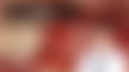 Implant placement in the patient with severe periodontitis