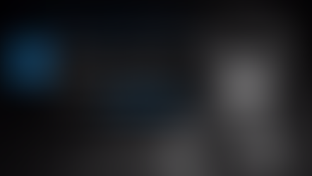 Management of Atrophic Posterior Maxilla by "3-S concept" SLA technique clinical cases #2