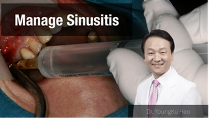 Management of sinusitis