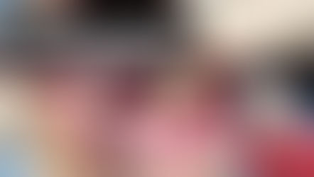 Root-Guided implant surgery and immediate loading with immediate provisionals