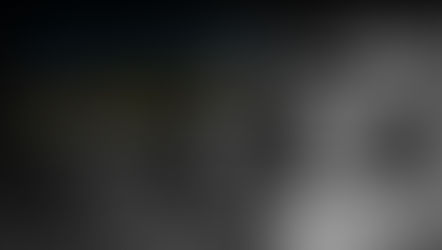 How to Predictably place and Restore implants within days of each other