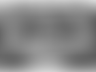 Sinus Class III CM and Class IV CM/C Fixations with SCA and SLA Techniques