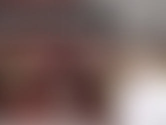 Removal of a fractured implant screw