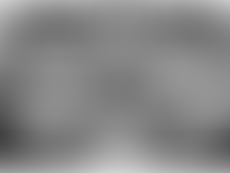 Ridge splitting in posterior mandible using Ridge Wider Kit