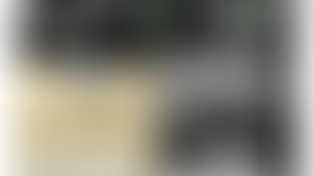 Immediate loading of anterior maxilla with Neo NaviGuide