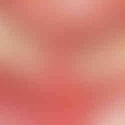 implant, lower anterior, VAROGuide, S-narrow, GAO, Neobiotech, IS3