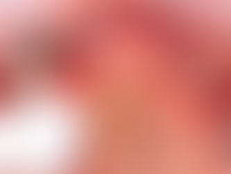  From Collapsed Bite to FP1 Stability : A Digital Workflow–Based Implant Case Utilizing Neo-Naviguide