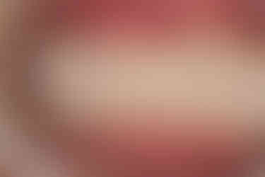 Left Lateral Intraoral View