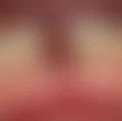 implant, lower anterior, VAROGuide, S-narrow, GAO, Neobiotech, IS3