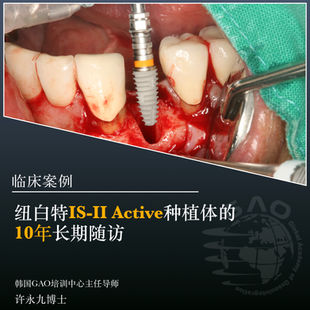 纽白特IS-II Active种植体的10年长期随访