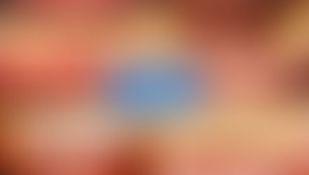 Root-guided Implant Surgery & Immediate Loading