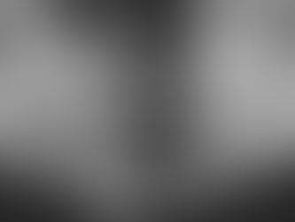 6 year Result of Simultaneous Implant Placement after Sinus Elevation through the Crestal Approach