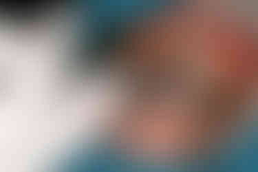 After aspiration, the maxillary sinus was irrigated with sterile saline