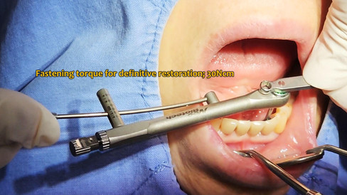 Torque Value: 30 Ncm