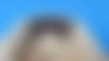 Final PFM prosthesis