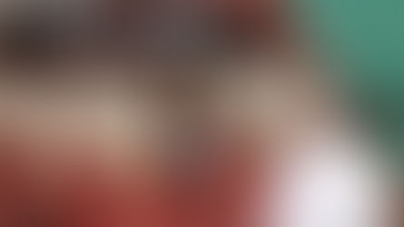 10 years long term follow-up of IS-II Active 