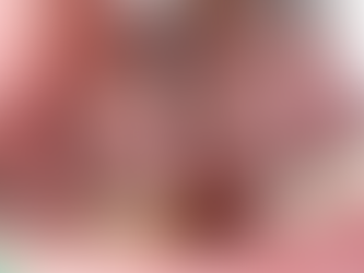 Removal of a fractured implant screw