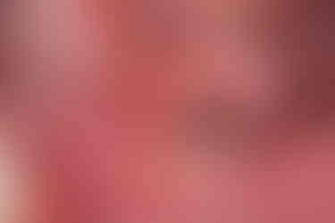 An incision is made at the surgical site where the ridge is narrow and requires bone grafting.