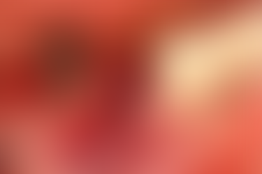 A YK abutment was connected to the implant following placement.