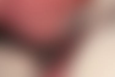 To ensure a safe and precise surgery, the guide is stabilized using vertical anchors.