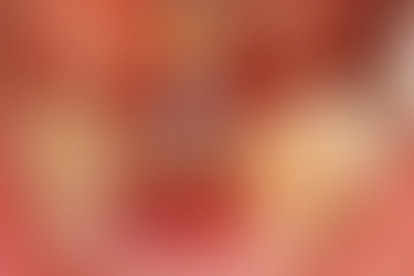 Threading of the alveolar bone was achieved through pre-tapping, followed by implant placement while tactile resistance of the threads was assessed.