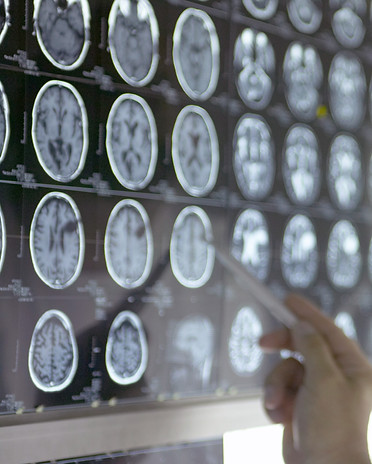 Doctor Analyzing X-Rays_edited_edited.jp