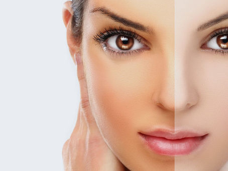 9 Easy Homemade Skin Lightening Remedies