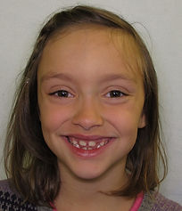 Guinn, R. before smile.jpg