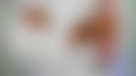 Questions to Ask Your Doctor