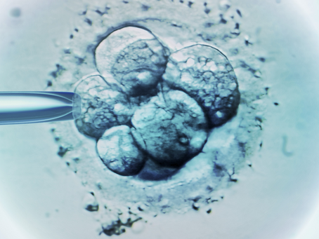 Single Embryo Transfer: Understanding The Science And Safety Behind Your Fertility Doctor’s Decision