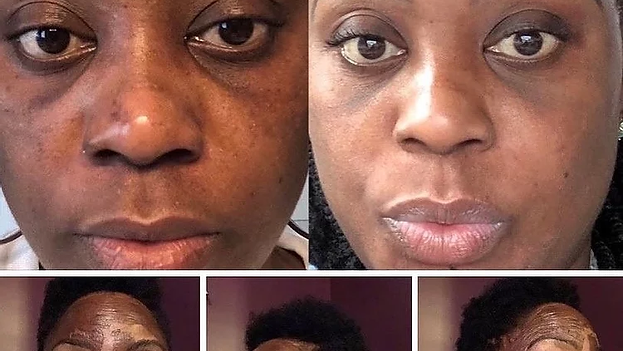 Level 3 INTENSIVE GET GLOWING Chemical Peel