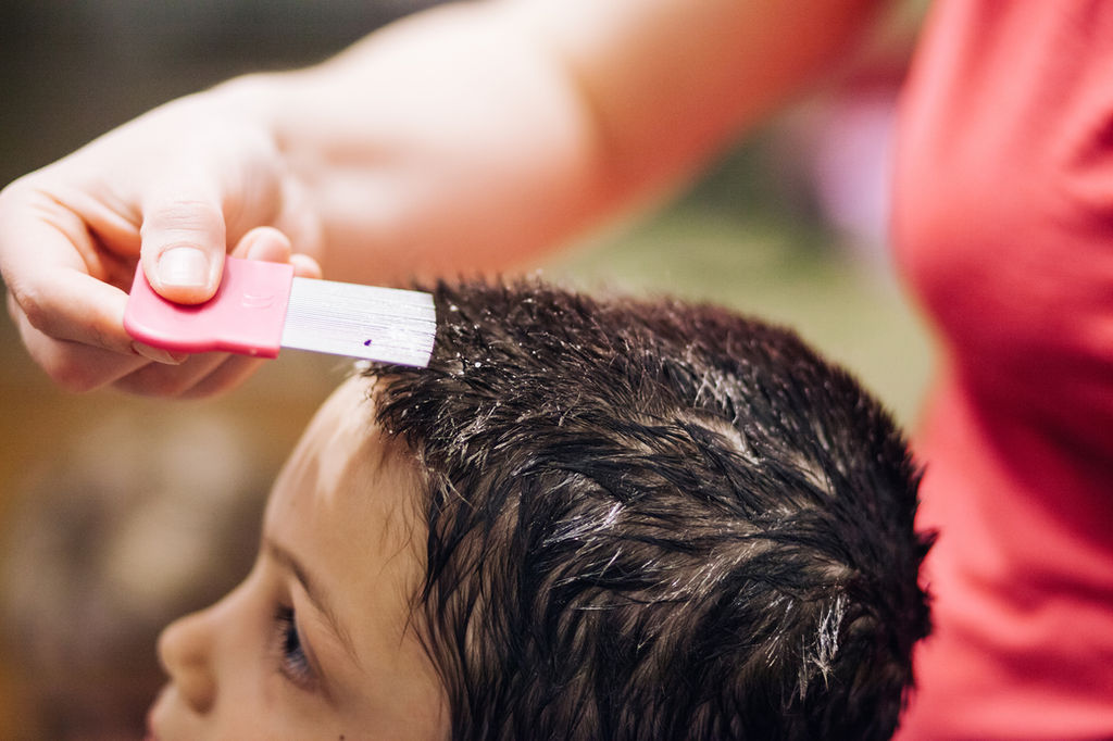 Yt Hair Loss Replacement Blog
