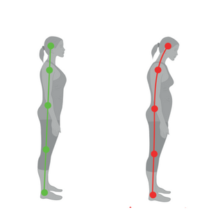 腰が痛い人は姿勢を治すべき!
