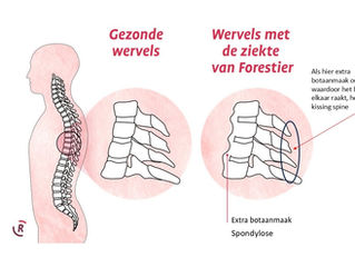 Mijn vader als paard