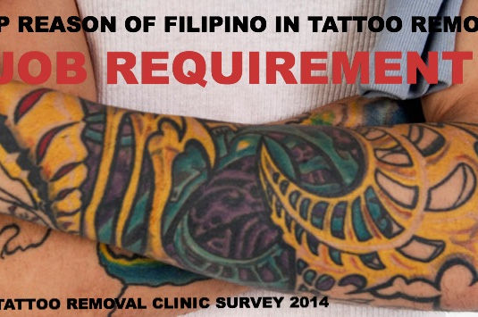 TOP REASON OF FILIPINOS IN TATTOO REMOVAL