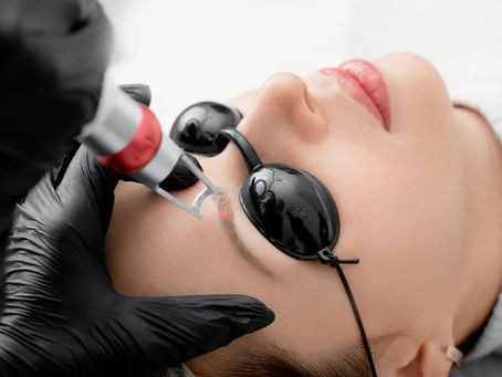 Before Going to Eyebrows - Laser Tattoo Removal, You need to read this
