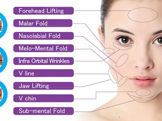 Ultra V Lift - Medico Global Clinic in Taguig