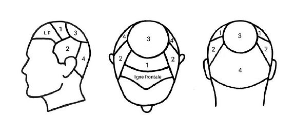 ZONE TRICHO HOMME.jpg