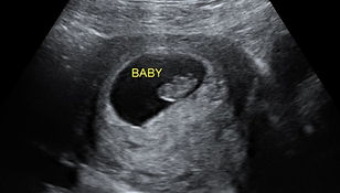 2D Ultrasound