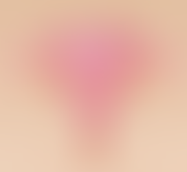 Improving Endometriosis Diagnosis: A Path to Better Women's Health