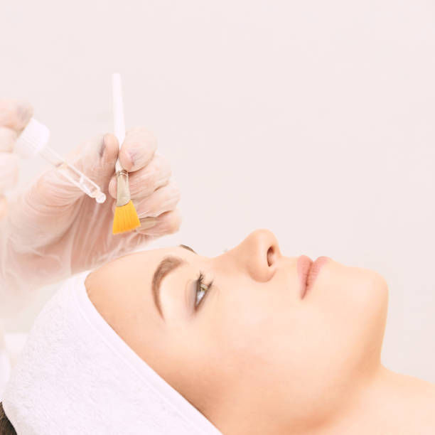 Facial Glycolic Peel