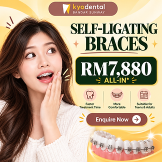 Self-Ligating Braces Promotion.png