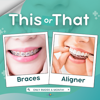 Braces Offer WIX (1).png