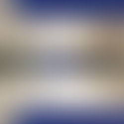 Put & Call Options - there's a catch 