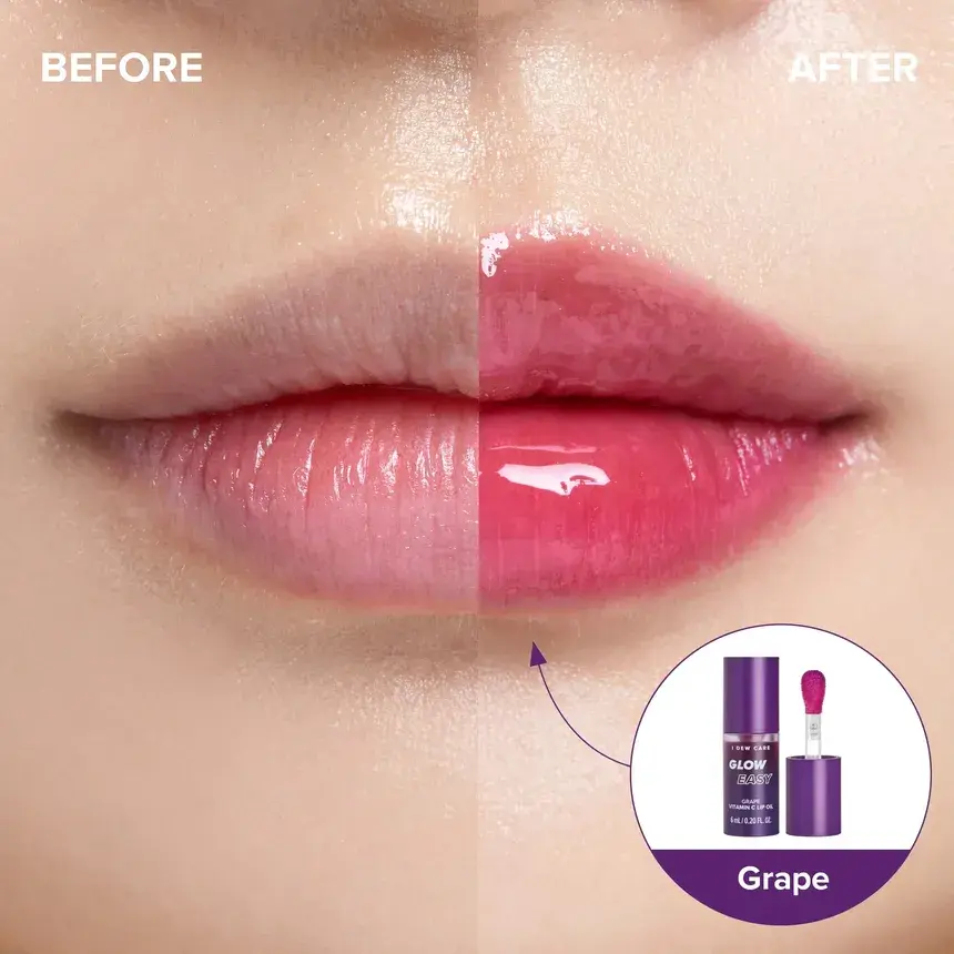 Thumbnail: I DEW CARE - Glow Easy Vitamin C Lip Oil - 3 Colors