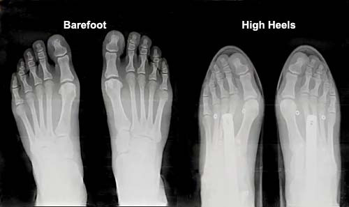 xray barefoot high heel