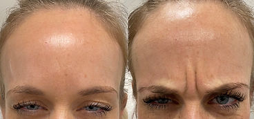 Anti-wrinkle, Gift Aesthetics